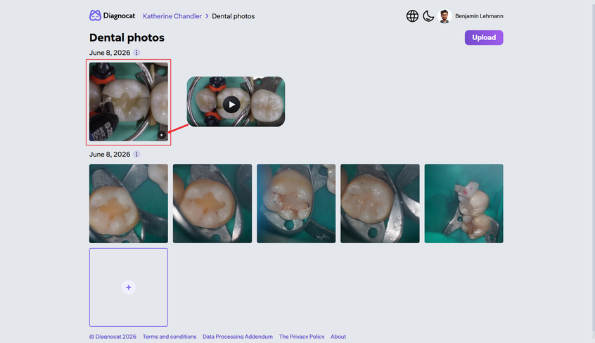 Dental photos section in Diagnocat with an uploaded video alongside patient photos